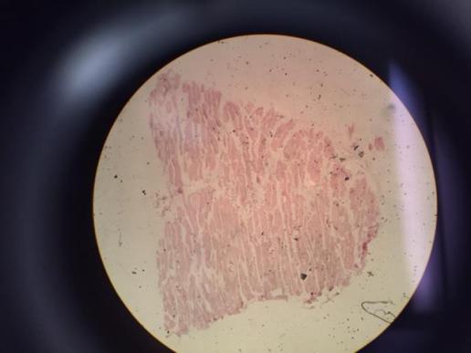 Trichinella spiralis; 4x Magnification Light Microscope