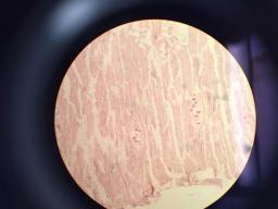 Trichinella spiralis; 10x Magnification Light Microscope