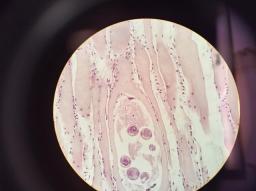 Trichinella spiralis; 40x Magnification Light Microscope